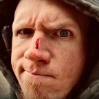 Once Bitten, Twice Shy